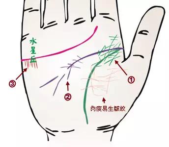 掌纹诊病图片,掌纹能查出糖尿病吗