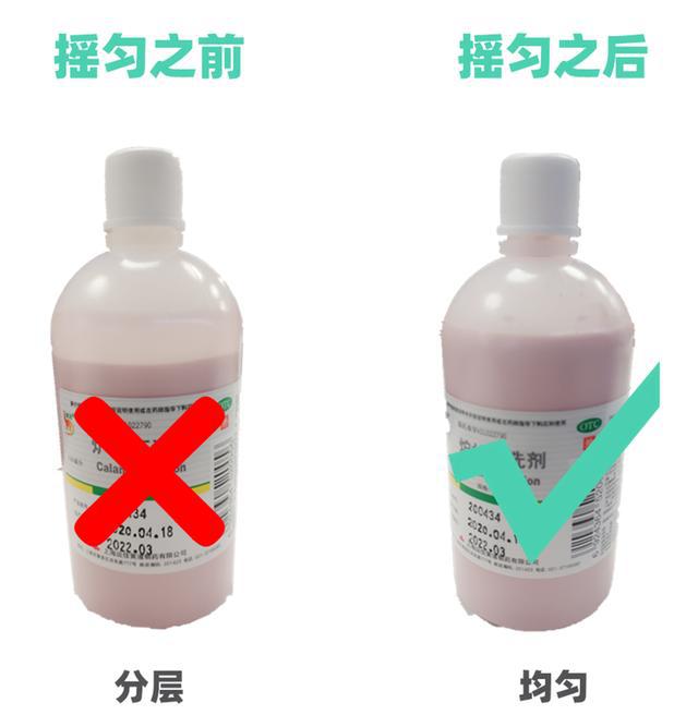 炉甘石治疗手痒正确用法,炉甘石洗剂老年人瘙痒