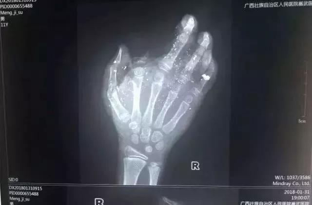 手机充电的时候着火怎么办,手机半夜充电起火怎么办