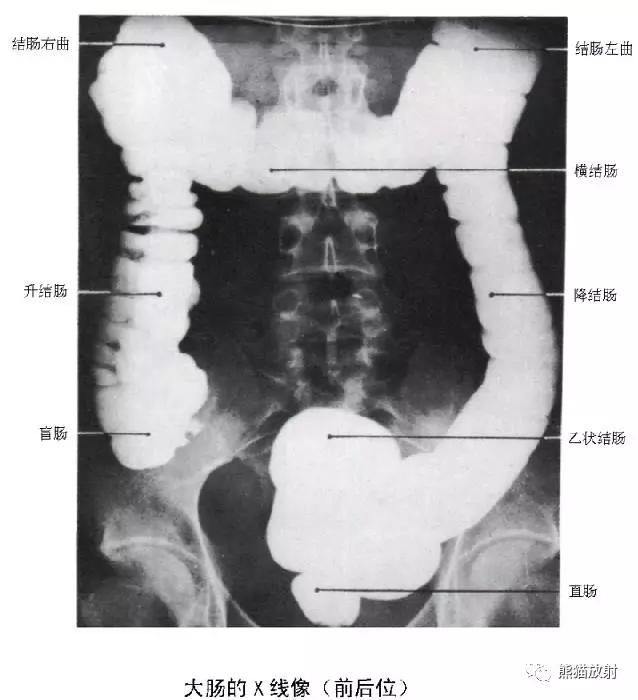 详细的消化道造影+彩色解剖图