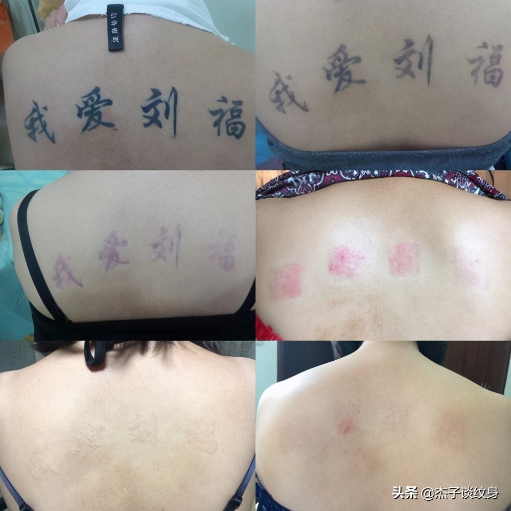 在哪里洗纹身最好,洗纹身液可以把纹身洗掉吗