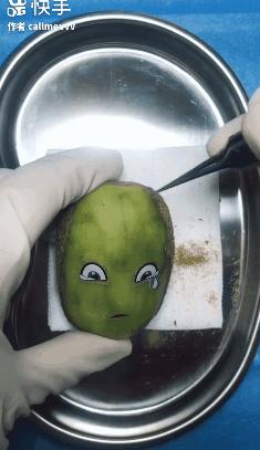 香蕉割包皮，洋葱剖腹产？这是我见过最秀的医生