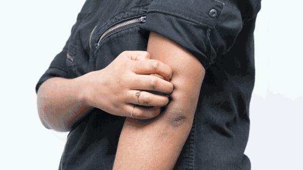 澳洲绵羊油对敏感肌有用吗,澳洲绵羊油保湿霜精华