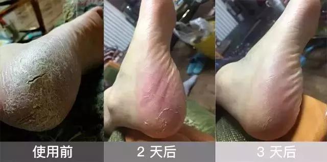 邓超日常被娘娘吐槽,邓超吐槽娘娘短发