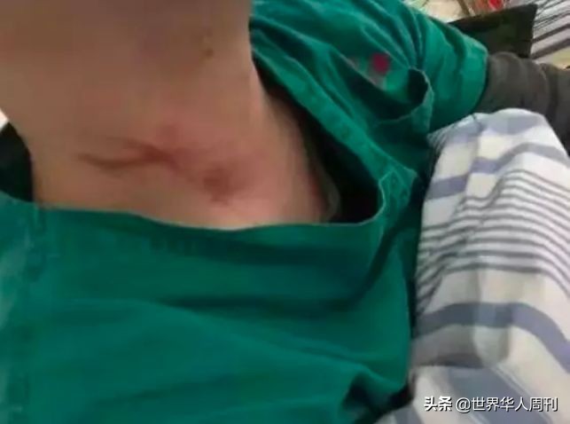 被砍医生陶勇恢复出诊,砍伤陶勇医生怎么处理