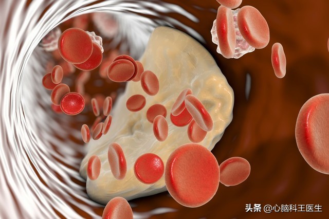 疏通血管输液7天大概多少钱,春季疏通血管什么时间输液好
