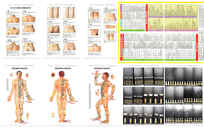 胃肠炎艾灸哪个穴位最好,肠胃不好肚子疼用艾灸什么穴位