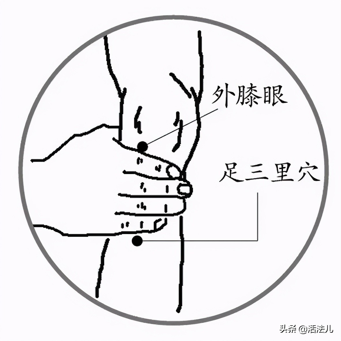 健康养生一招祛除眼袋,程凯养生说怎样去除眼袋