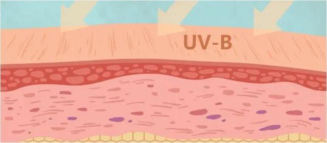 25岁就有颈纹了是怎么回事,30岁脖子颈纹好深怎么办