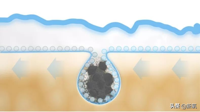 家用美容仪怎么选适合自己的,简单实用美容仪