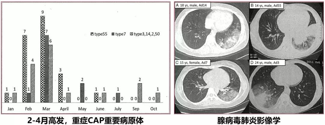 免疫正常成年CAP患者，非流感与流感病毒性肺炎病情严重程度相似